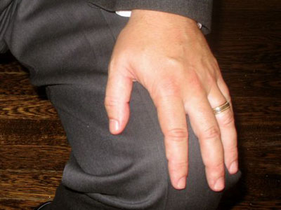 Hand_on_Knee_Interviewing